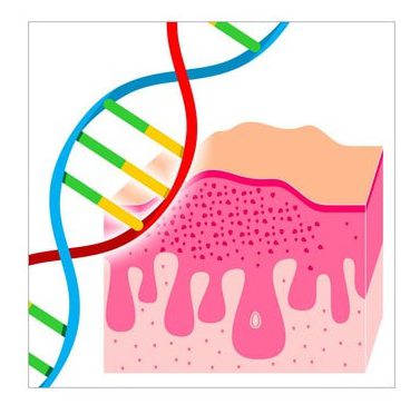 ژنتیک و سرطان پوست | خیز